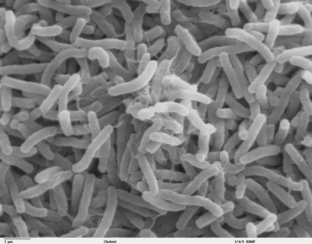 Vibrio cholerae (ou bacille virgule), à l'origine du choléra - Wikimedia