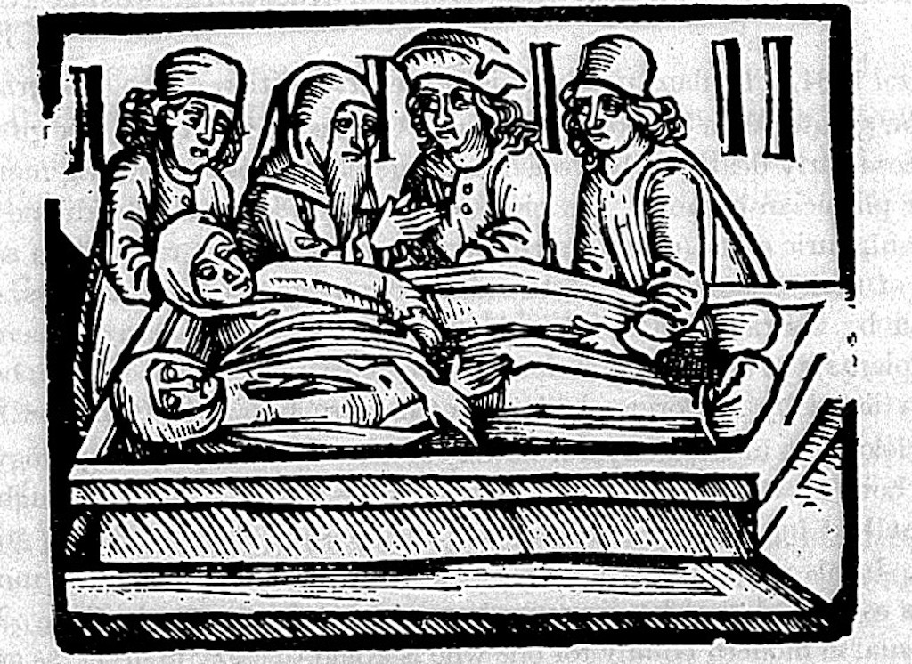 Sweating sickness 16th century